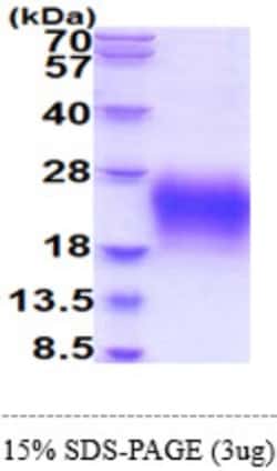 Novus Biologicals&trade;&nbsp;CD79A Recombinant Protein
